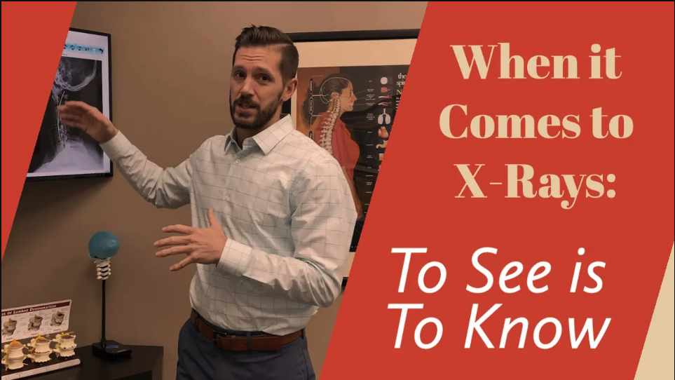 Why X-Rays are So Important | Chiropractor for Headaches in Westlake, OH